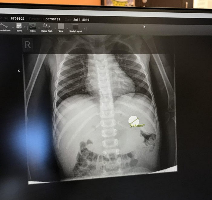 26 լուսանկար, որոնք ապացուցում են. Ծնողներին անհրաժեշտ է պողպատե նյարդեր