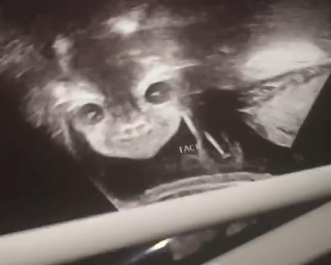 ՈՒլտրաձայնային հետազոտության 15 զվարճալի կադր ապագա մայրիկներից, որոնք Ձեզ անտարբեր չեն թողնի։