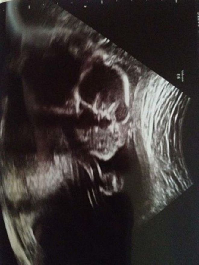 ՈՒլտրաձայնային հետազոտության 15 զվարճալի կադր ապագա մայրիկներից, որոնք Ձեզ անտարբեր չեն թողնի։