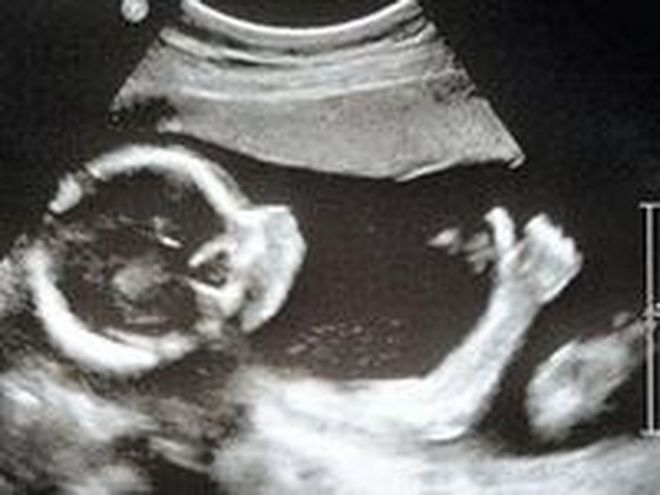 ՈՒլտրաձայնային հետազոտության 15 զվարճալի կադր ապագա մայրիկներից, որոնք Ձեզ անտարբեր չեն թողնի։