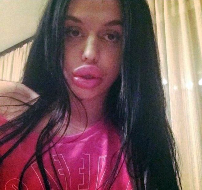 25 հմայիչ աղջիկներ, ովքեր վստահ են, որ գեղեցկությունը պետք է լինի շատ, շաա՜տ շատ