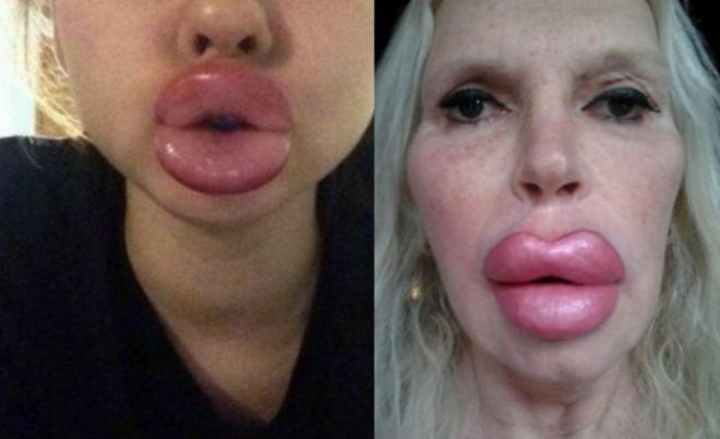 25 հմայիչ աղջիկներ, ովքեր վստահ են, որ գեղեցկությունը պետք է լինի շատ, շաա՜տ շատ