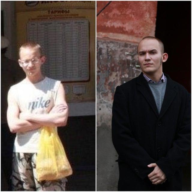 20+ անճոռնի ճուտիկներ, որոնք մեծանալով վերածվել են գեղեցիկ մարդկանց: