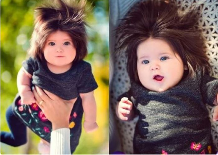 Փոքրիկը ծնվել է փարթամ &laquo;սանրվածքով&raquo;. ինչպիսի տեսք ունի հիմա փոքրիկ Ռապունցելը