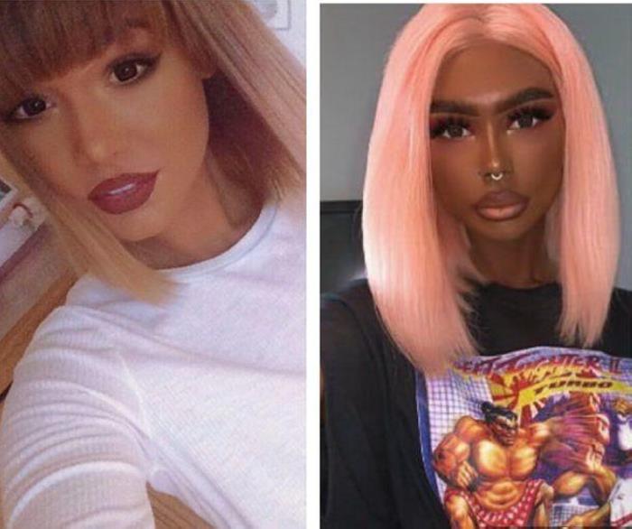 Պլաստիկ վիրաբույժների 18 հիվանդներ, որոնք, անշուշտ, զղջում են իրենց արածի համար, բայց արդեն ուշ է