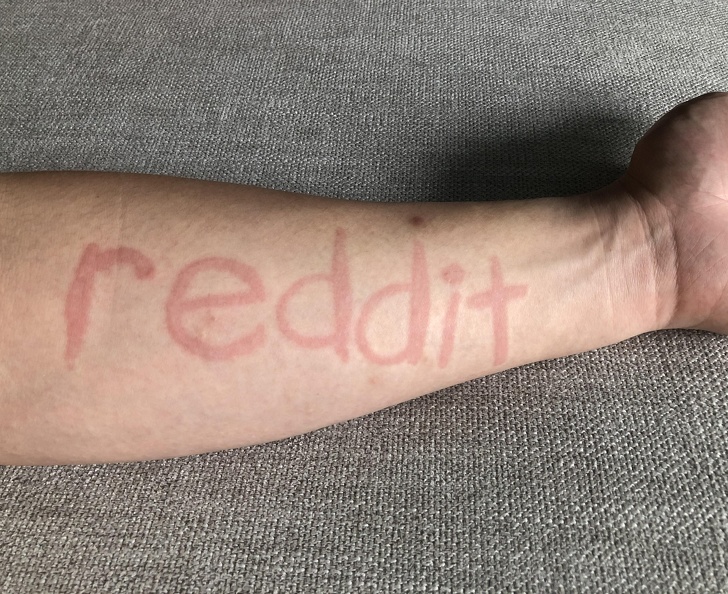 16 հասարակ մարդիկ, ովքեր իրենց մեջ անսովոր սուպերունակություններ են հայտնաբերել