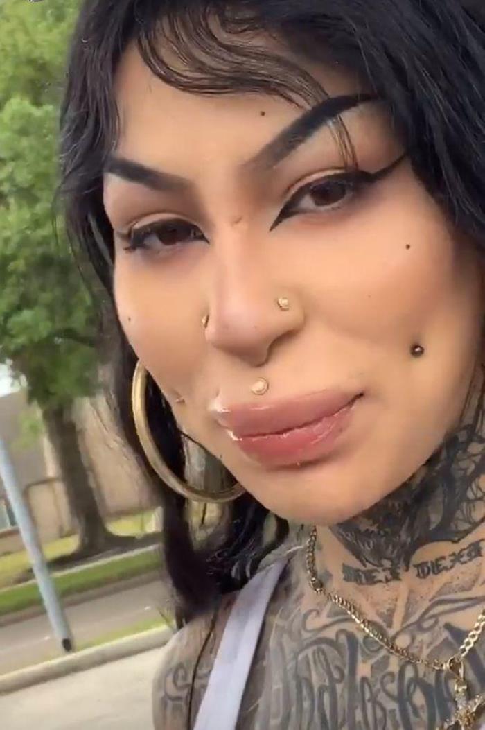 Պլաստիկ վիրաբույժների 18 հիվանդներ, որոնք, անշուշտ, զղջում են իրենց արածի համար, բայց արդեն ուշ է