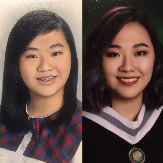 20+ անճոռնի ճուտիկներ, որոնք մեծանալով վերածվել են գեղեցիկ մարդկանց: