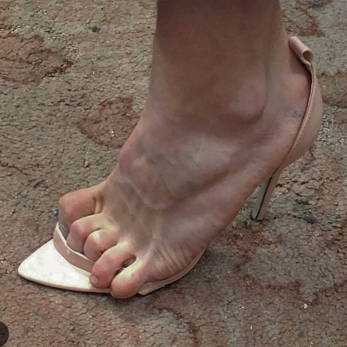 Այս կոշիկները ստեղծվել են տանջելու համար։ Ամենաանհարմար կոշիկները, որոնք դուք երբևէ տեսել եք