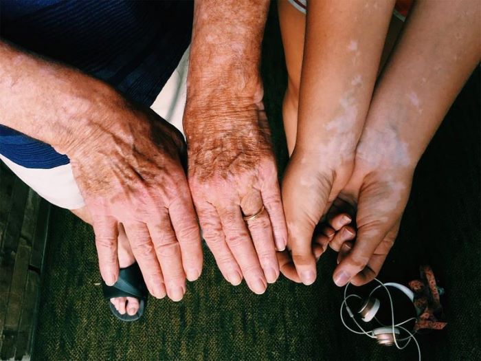 19 ապացույց, որ գենետիկան հզոր և անկանխատեսելի ուժ է: