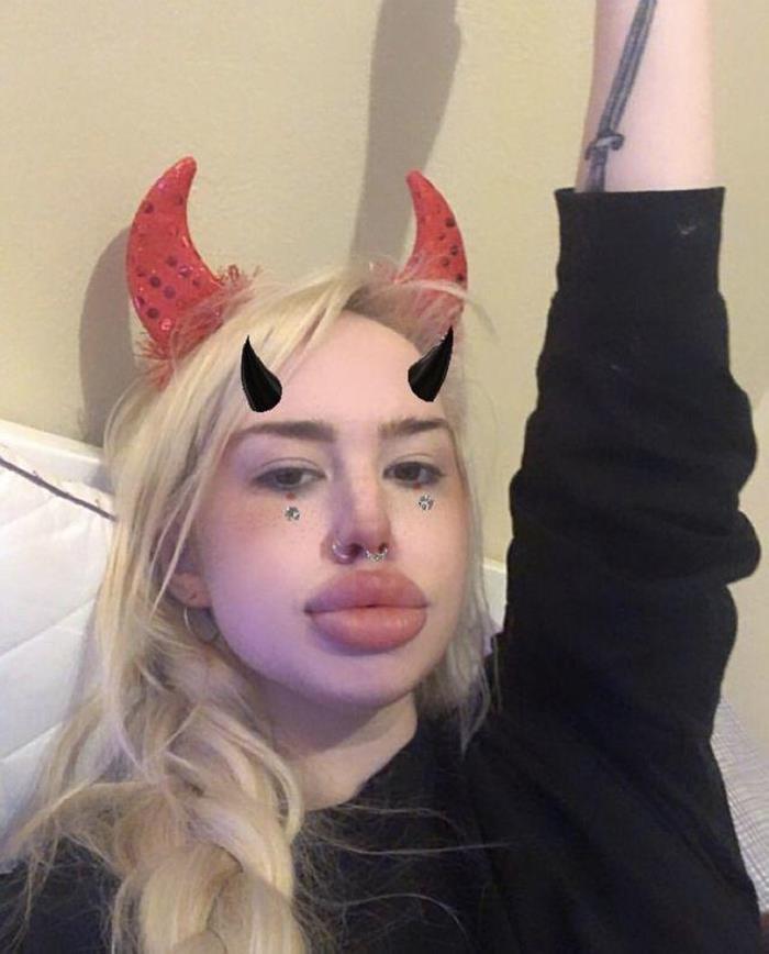 Պլաստիկ վիրաբույժների 18 հիվանդներ, որոնք, անշուշտ, զղջում են իրենց արածի համար, բայց արդեն ուշ է