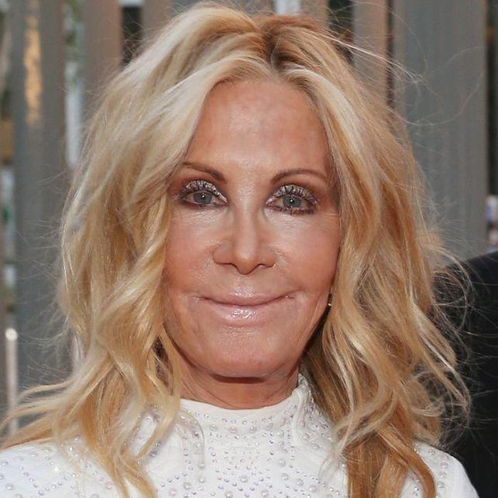 Պլաստիկ վիրաբույժների 18 հիվանդներ, որոնք, անշուշտ, զղջում են իրենց արածի համար, բայց արդեն ուշ է