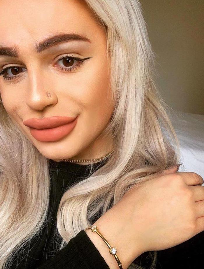 Պլաստիկ վիրաբույժների 18 հիվանդներ, որոնք, անշուշտ, զղջում են իրենց արածի համար, բայց արդեն ուշ է