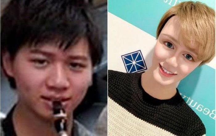 Պլաստիկ վիրաբույժների 18 հիվանդներ, որոնք, անշուշտ, զղջում են իրենց արածի համար, բայց արդեն ուշ է