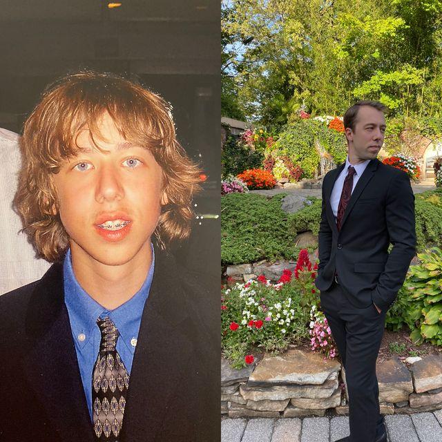 20+ անճոռնի ճուտիկներ, որոնք մեծանալով վերածվել են գեղեցիկ մարդկանց: