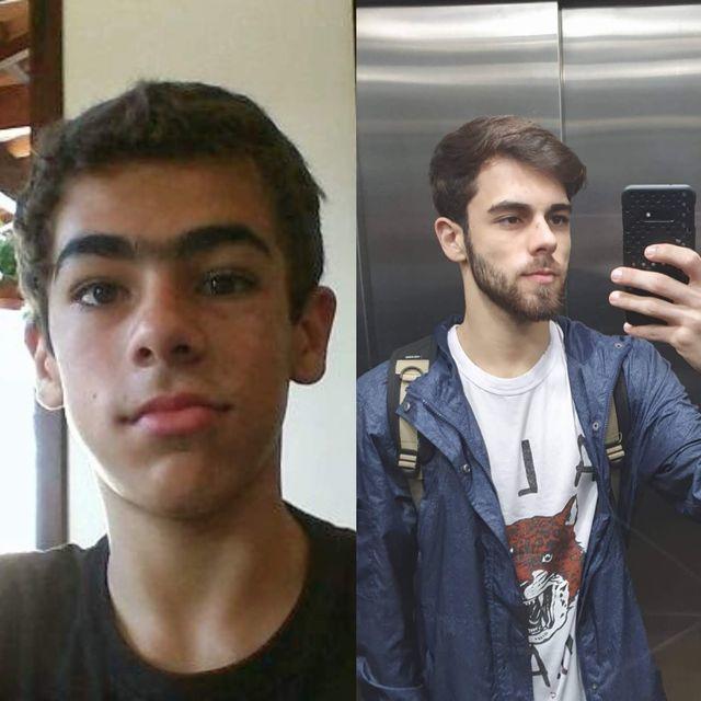 20+ անճոռնի ճուտիկներ, որոնք մեծանալով վերածվել են գեղեցիկ մարդկանց: