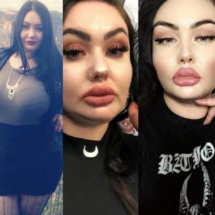 Պլաստիկ վիրաբույժների 18 հիվանդներ, որոնք, անշուշտ, զղջում են իրենց արածի համար, բայց արդեն ուշ է