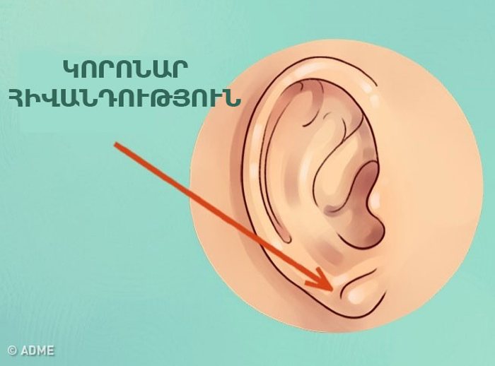 Իմացեք՝ ձեր ականջներն ինչ են ասում ձեր մասին