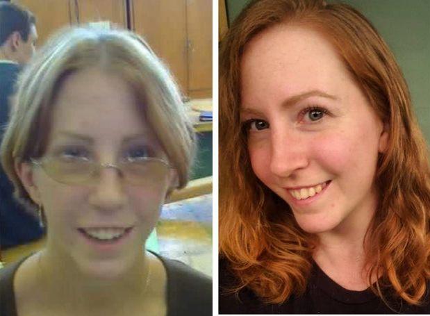 20+ անճոռնի ճուտիկներ, որոնք մեծանալով վերածվել են գեղեցիկ մարդկանց: