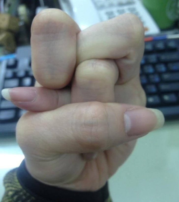 16 հասարակ մարդիկ, ովքեր իրենց մեջ անսովոր սուպերունակություններ են հայտնաբերել