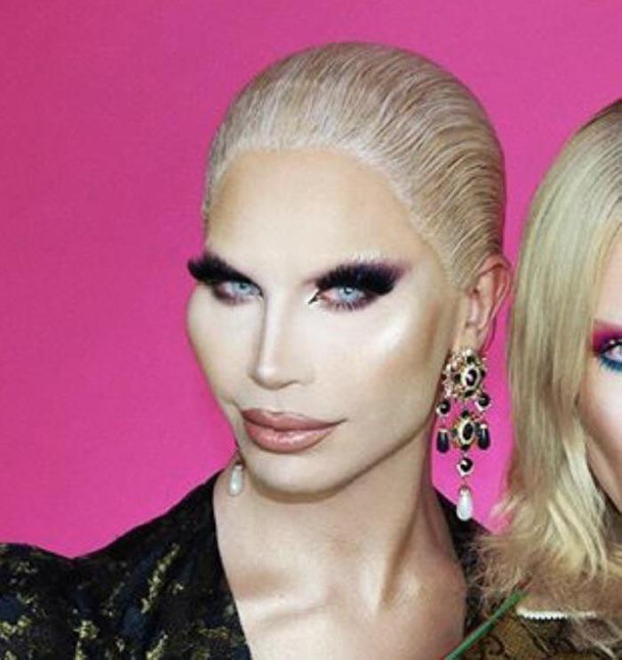 Պլաստիկ վիրաբույժների 18 հիվանդներ, որոնք, անշուշտ, զղջում են իրենց արածի համար, բայց արդեն ուշ է