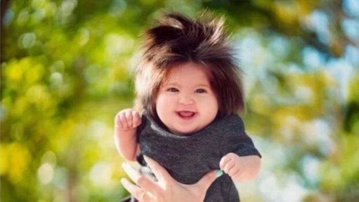 Փոքրիկը ծնվել է փարթամ &laquo;սանրվածքով&raquo;. ինչպիսի տեսք ունի հիմա փոքրիկ Ռապունցելը