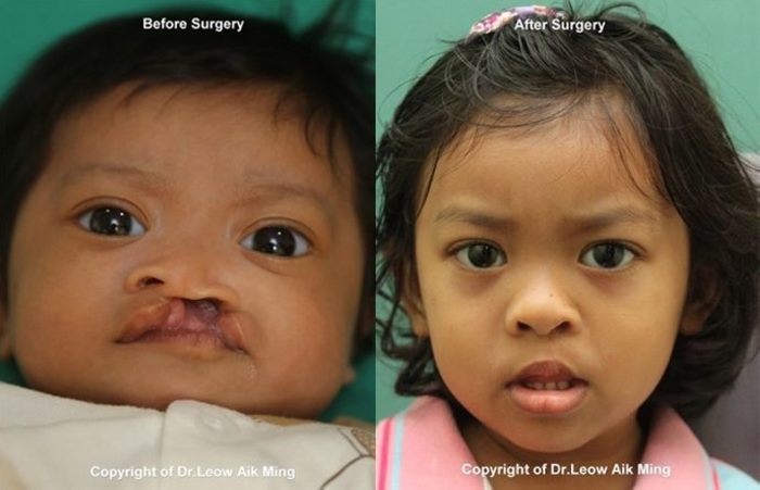 8 լուսանկար, թե ինչու է պլաստիկ վիրաբուժությունը իրականում անհրաժեշտ