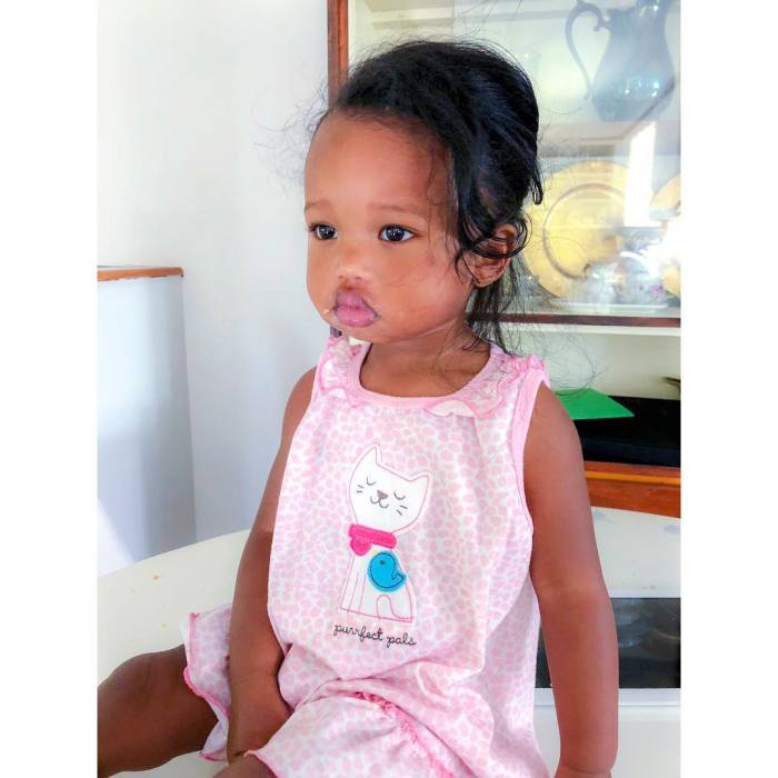 Յուրահատուկ շուրթերով աղջնակը նվաճել է համացանցը