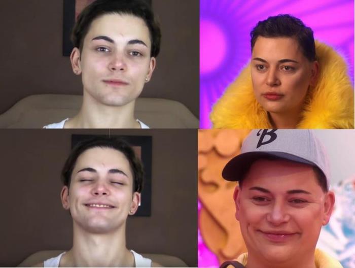 Պլաստիկ վիրաբույժների 18 հիվանդներ, որոնք, անշուշտ, զղջում են իրենց արածի համար, բայց արդեն ուշ է