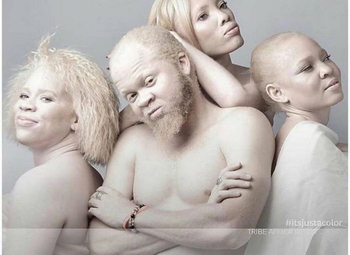 19 ապացույց, որ գենետիկան հզոր և անկանխատեսելի ուժ է: