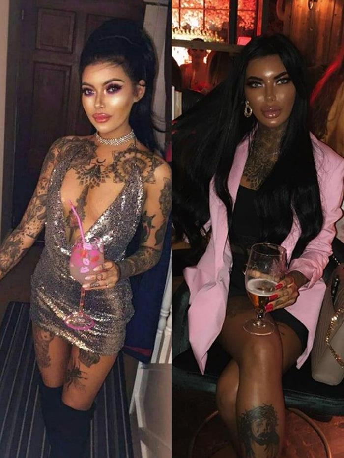 Պլաստիկ վիրաբույժների 18 հիվանդներ, որոնք, անշուշտ, զղջում են իրենց արածի համար, բայց արդեն ուշ է