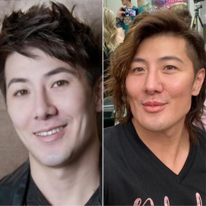 17 անհաջողակներ, որոնց ոչ հաջողված պլաստիկ վիրահատությունը չի կոտրել, այլ ավելի է վատթարացրել