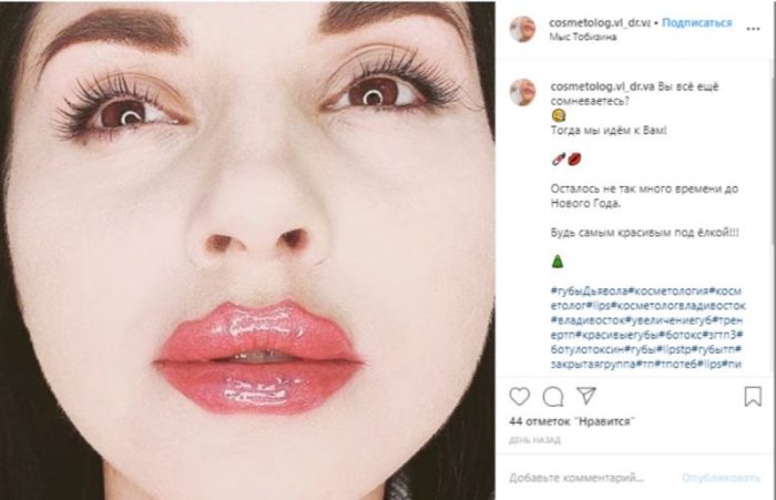 Instagram-ը գրավել է նոր թրենդը՝ շուրթեր֊ութոտնուկը