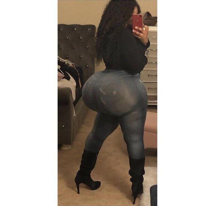 17 անհաջողակներ, որոնց ոչ հաջողված պլաստիկ վիրահատությունը չի կոտրել, այլ ավելի է վատթարացրել