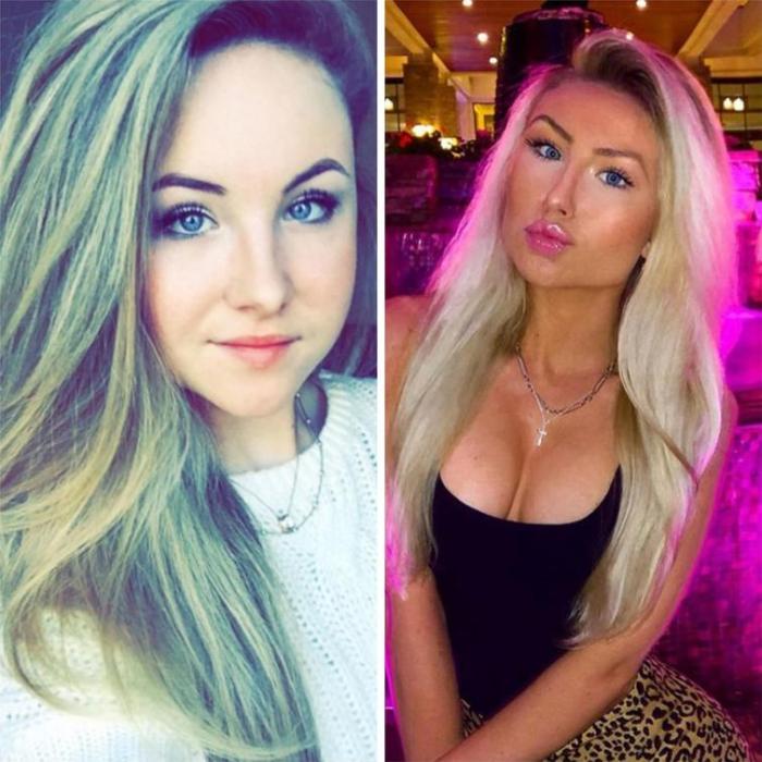 17 անհաջողակներ, որոնց ոչ հաջողված պլաստիկ վիրահատությունը չի կոտրել, այլ ավելի է վատթարացրել