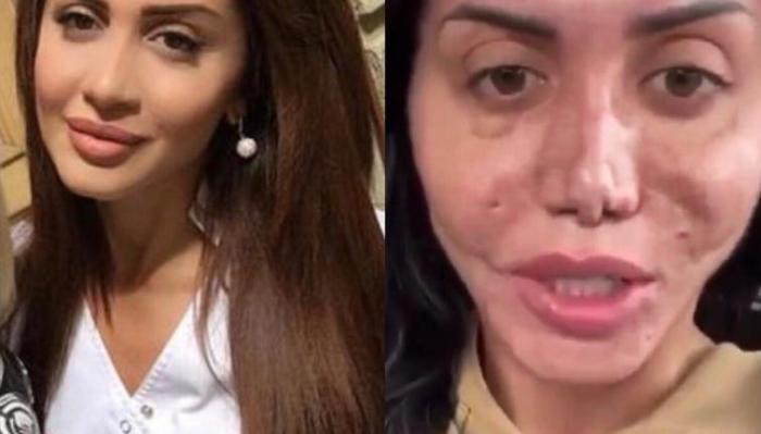 17 անհաջողակներ, որոնց ոչ հաջողված պլաստիկ վիրահատությունը չի կոտրել, այլ ավելի է վատթարացրել