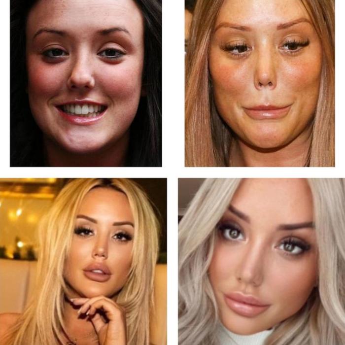 17 անհաջողակներ, որոնց ոչ հաջողված պլաստիկ վիրահատությունը չի կոտրել, այլ ավելի է վատթարացրել