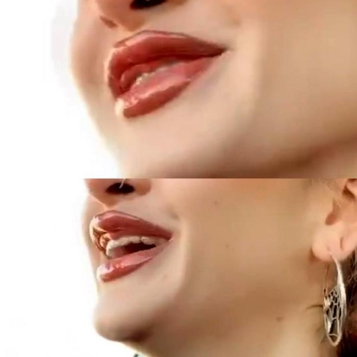 17 անհաջողակներ, որոնց ոչ հաջողված պլաստիկ վիրահատությունը չի կոտրել, այլ ավելի է վատթարացրել