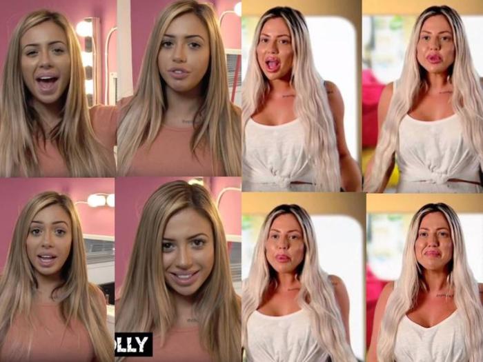 17 անհաջողակներ, որոնց ոչ հաջողված պլաստիկ վիրահատությունը չի կոտրել, այլ ավելի է վատթարացրել