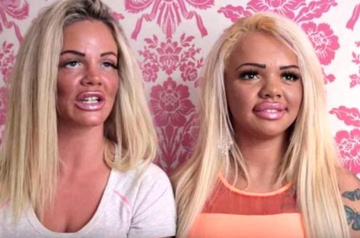 17 անհաջողակներ, որոնց ոչ հաջողված պլաստիկ վիրահատությունը չի կոտրել, այլ ավելի է վատթարացրել