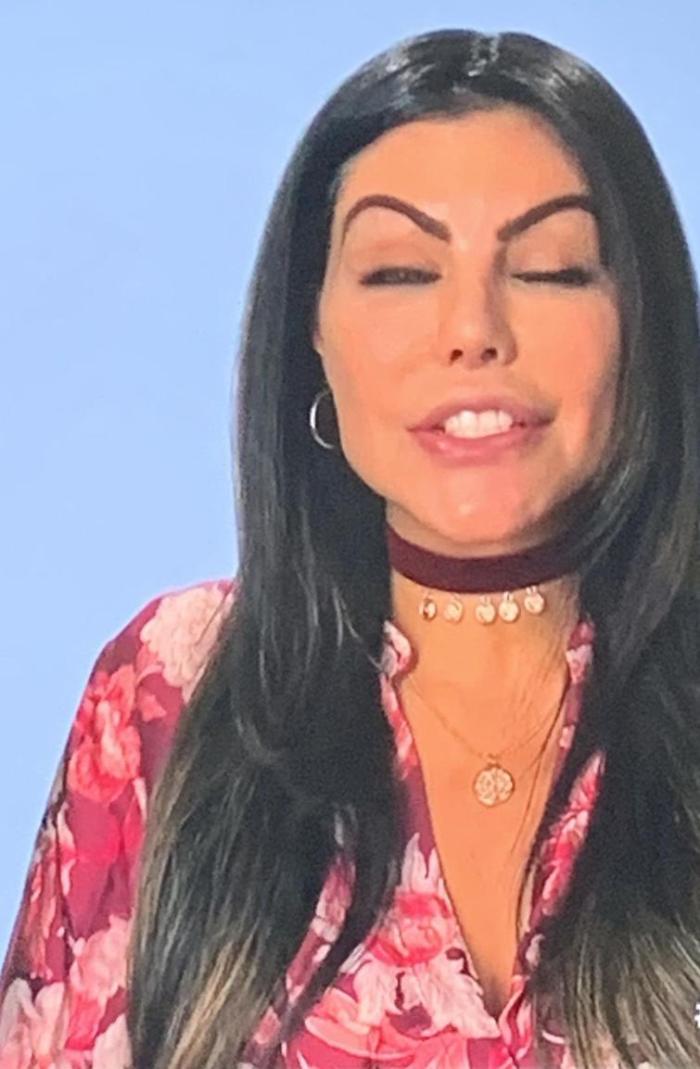 17 անհաջողակներ, որոնց ոչ հաջողված պլաստիկ վիրահատությունը չի կոտրել, այլ ավելի է վատթարացրել