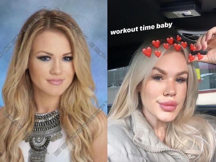 17 անհաջողակներ, որոնց ոչ հաջողված պլաստիկ վիրահատությունը չի կոտրել, այլ ավելի է վատթարացրել