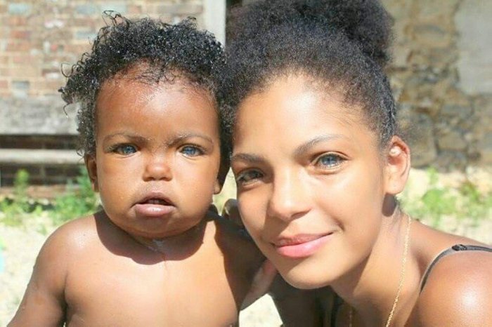 20 հիանալի գենետիկ մուտացիաներ մարդկության մեջ