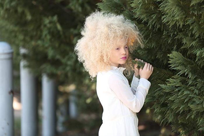 Աֆրիկյան ալբինոս աղջիկը իր առանձնահատկությունը վերածել է արժանապատվության