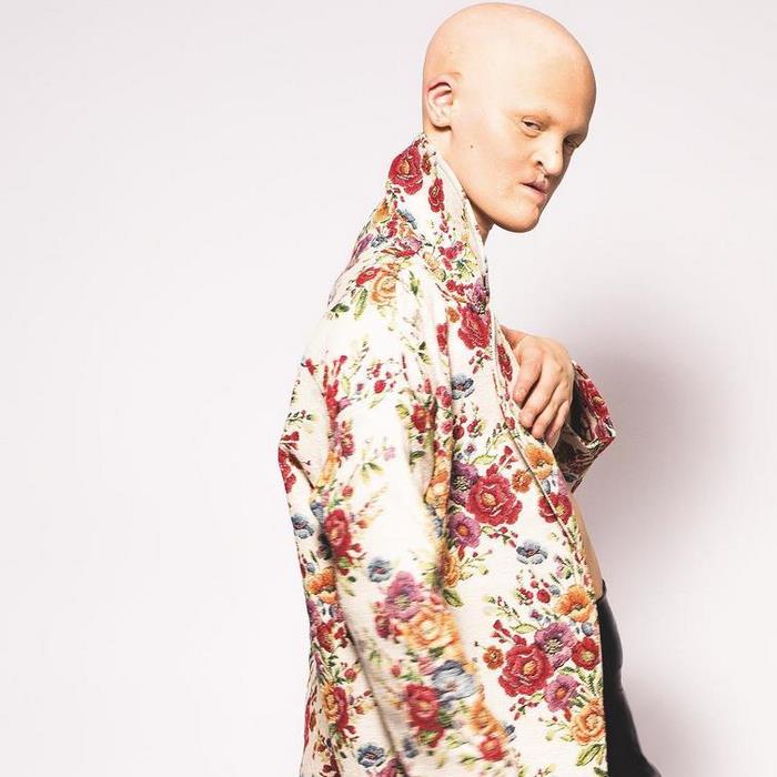 Այլ կարգի գեղեցկություն կամ 30 հոգի, որոնց արտաքինը սովորականի շրջանակից դուրս է