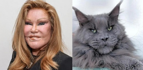 «Կին-կատու». Կյանքը պլաստիկ վիրահատությունից առաջ և հետո