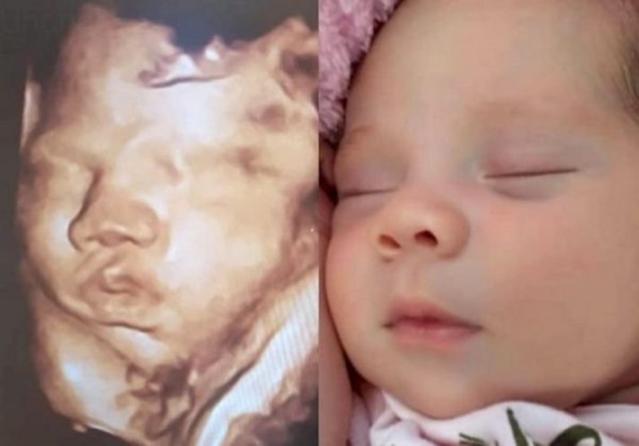 Դուստրը ծնվելիս արդեն իսկ &laquo;հղի&raquo; էր, ինչպե՞ս կարող է դա լինել