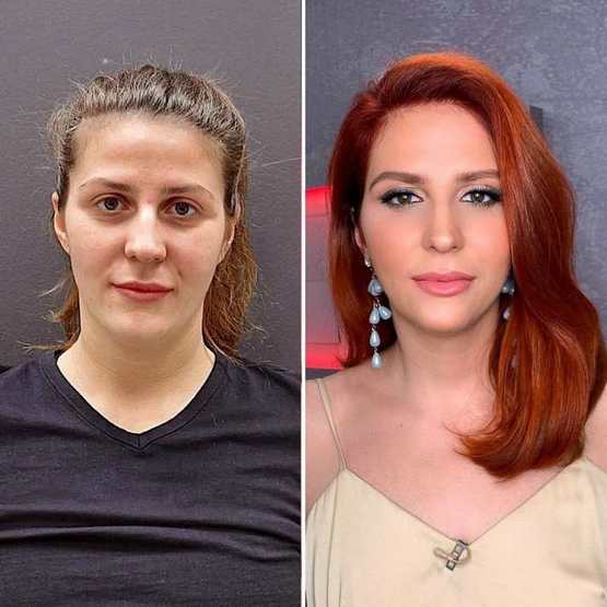 &laquo;Մի փոքր խնամք և խնդրե՛մ&raquo;. Կանայք, որոնք սագերից վերածվել են կարապների