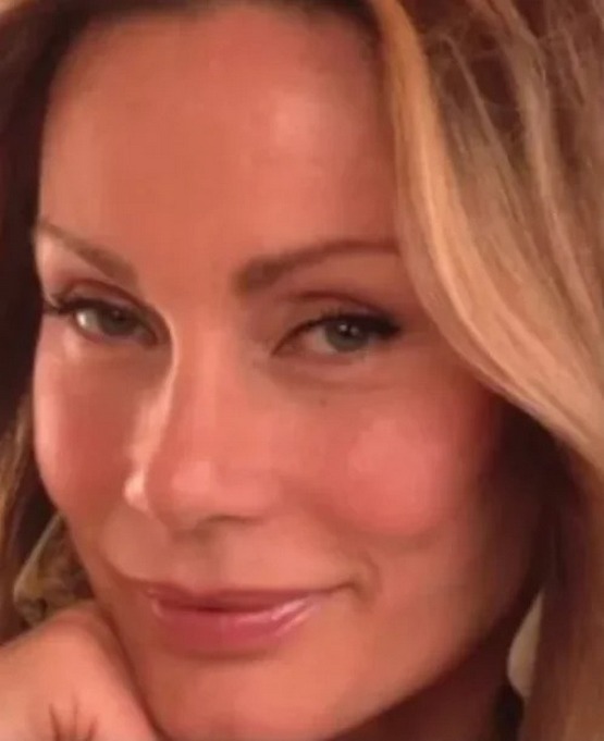 «Կին-կատու». Կյանքը պլաստիկ վիրահատությունից առաջ և հետո