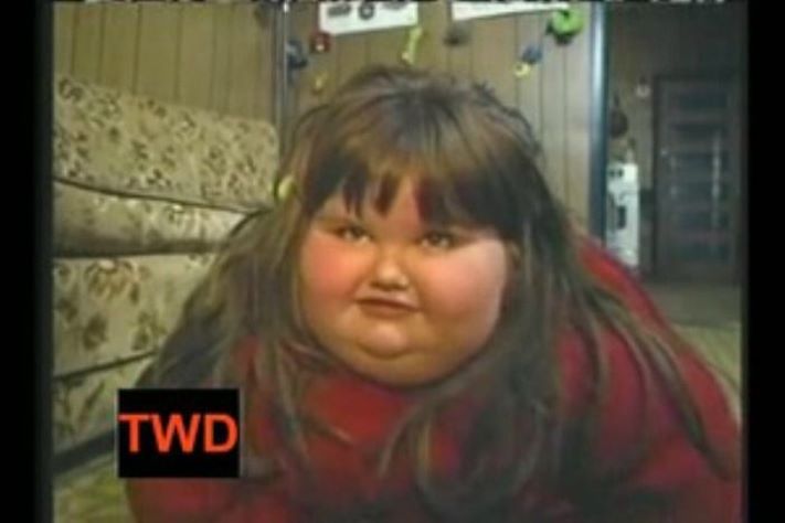 Ինչպի՞սի տեսք ունի աշխարհի ամենագեր աղջիկն այժմ` նիհարելուց հետո